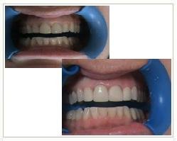 Slider image (8) Alfadent